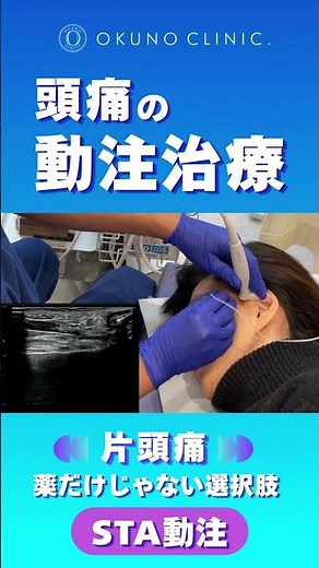 薬が効かない頭痛に「STA動注」という選択肢