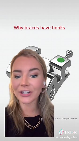 Understanding Braces Hooks: Types and Functions