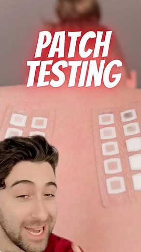 What is PATCH TESTING ? Skin allergy test !