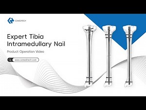 Expert Tibial Intramedullary Nailing – Step-by-Step Surgical Procedure