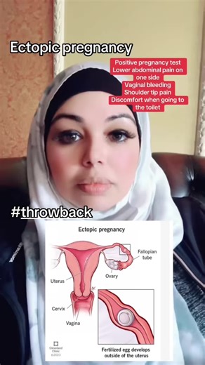 Understanding Ectopic Pregnancy Symptoms and Awareness