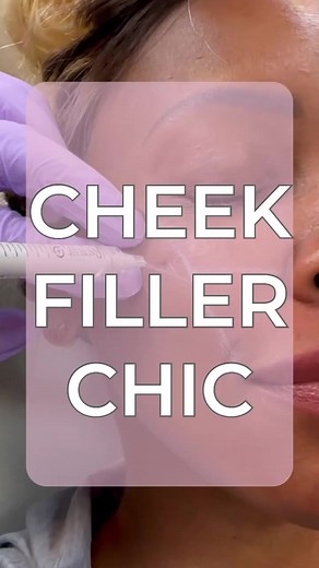 Split Screen Chic! 🌟 Left: Cheek filler sculpting perfection and elevation Right: Unfiltered beauty in its raw form. 💫 Cheek fillers are designed to lift your cheekbones, add volume to your face, and smooth fine lines and wrinkles.By injecting fillers into the mid-face, Dr Kaado is attempting to restore lost volume, and lift the facial tissue that has started to drop. #CheekFillerCanvas #NaturalVersusEnhanced••To schedule an appointment or speak with a member of the Kaado Krew, please contact 