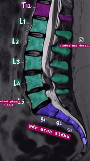 Interpret MRI for lumbar spine