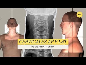 RADIOGRAFÍA COL.CERVICAL (AP Y LAT) POSICIONAMIENTO FACIL Y RAPIDO #medico