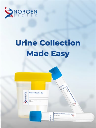 This video demonstrates how to use Norgen Biotek’s new Urine Nucleic Acid Collection and Preservation System for simple, non-invasive urine sample collection. The system stabilizes DNA and RNA at ambient temperature, helping preserve nucleic acid integrity during collection, storage, and transport. The workflow supports applications including liquid biopsy research, biomarker discovery, molecular diagnostics, and genomics analysis.