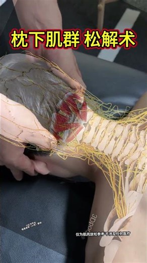 Suboccipital Muscle Release Technique (High-Definition Tutorial) ||| #SuboccipitalMuscles #Should...