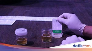Tes Urine untuk Apa? Kenali 6 Fungsi, Jenis, dan Prosedurnya