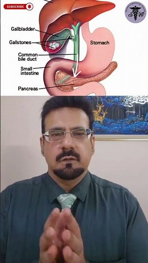 Gallstones, Gas, & Bloating - The Science Explained