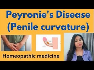 Peyronie's Disease ( Penile curvature) treatment without surgery !! Symptoms & causes !!