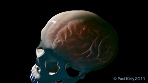 Concussions–Seeing the Invisible Injury