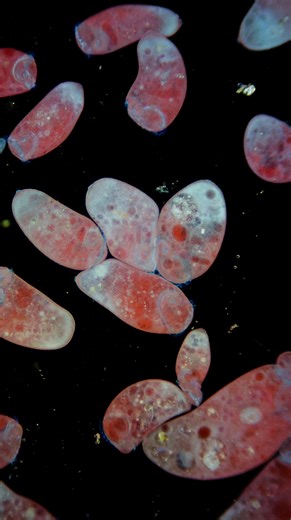 Pink Stentors, I've only seen them once #science #microscopy #biology #Cell #pink | Science into Images