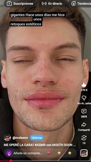 mol asmr 😂😂😂😂😂😂😂😂😂