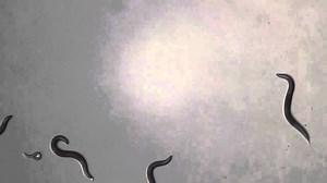 Scientists succeed in mapping every neuron in a worm, a breakthrough in neuroscience – Lifeboat News: The Blog