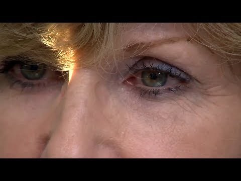 Mayo Clinic Minute: What you need to know about wet macular degeneration