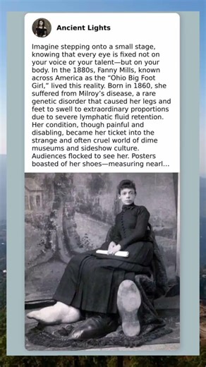 Gigantic Steps: The Extraordinary Life of Fanny Mills, the Ohio Big Foot Girl