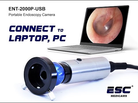 ESC Medicams Portable Endoscopy Camera ENT-2000P USB PC Connectivity
