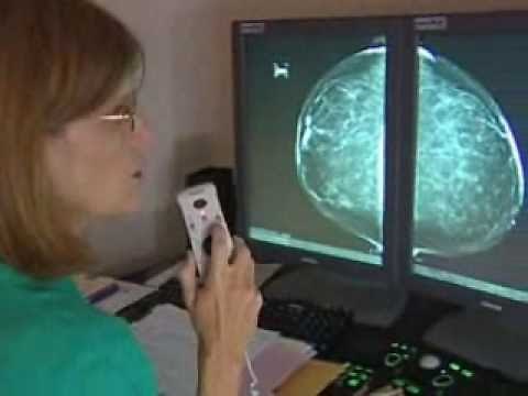 Diagnostic Mammography