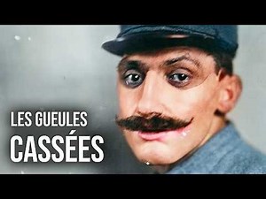 The Tragic Story of the “Gueules Cassées,” Martyrs of the Great War - HDG #59