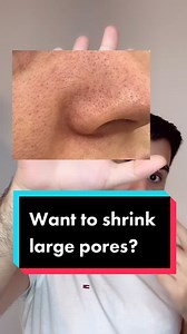 Effective Skincare for Men with Large Pores