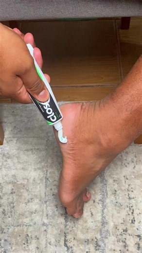 Apply toothpaste to your feet and wait next morning! #health #tips