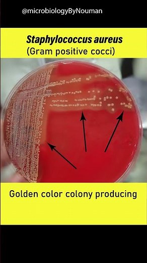 Staphylococcus aureus on Blood agar plate #shorts #youtubeshorts