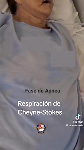 #DHO tips: Patrón respiratorio de Cheyne-Stokes 🧠 🔰Se llama Cheyne-Stokes, por los médicos John Cheyne y William Stokes, que lo describieron en el siglo XIX. 🔄 Patrón respiratorio de Cheyne-Stokes ✅ ¿Qué es? Es un patrón anormal y cíclico de respiración, donde hay: 1. Hipoventilación o apnea (pausa respiratoria de varios segundos), 2. seguida por una respiración que aumenta gradualmente en profundidad y frecuencia (hiperpnea), 3. y luego disminuye progresivamente, hasta otra vez llegar a la a