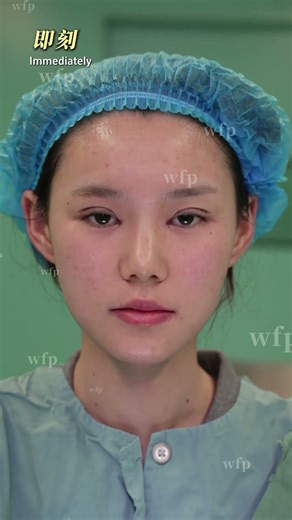 7mm small flat fan eye tail slightly raised