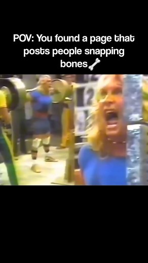 @peoplesnappingbones on Instagram: "Bodybuilder BREAKS leg while attemping a squat PR 😵 #bonebreaking #bonebreak"