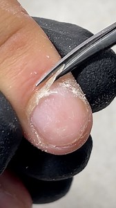 Everyday Nail Stylist Look at this cuticle 🫣 #everydaynail2 #nailart #nailsoftheday #nailvideo #nailtutorialvideo #naildesigns #nailtutorial #nails2inspire #nail #nails #longnails #nailswag #nailporn #nailpolish #nailsvideos #nailmagazine #nailpromagazine #nailsofig #nailsonfleek #nailsonpoint #nailedit #acrylicnailsdesign #ombrenails #nailstagram #chromenails | Everyday Nail Stylist