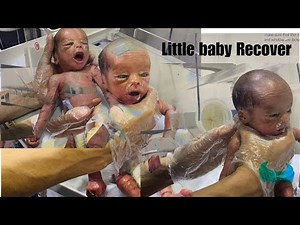 Our Collodion Baby: A Day-by-Day Journey to Healing