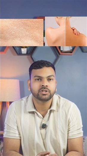 149 rupees m Body acne ka permanent solution 😳 Back & chest pimples treatment