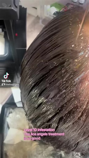 Effective Lice Treatment Solutions for Children