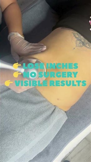 LOSE INCHES FAST 🔥 Body Contouring Treatment | No Surgery | Kissimmee