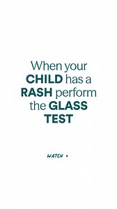 6.1M views · 260 reactions | This glass test is something you need in your parenting toolkit 拏 Press a clear glass firmly against the rash ⤵️ If the rash doesn't blanch (turn paler) under the pressure of the glass, it could be a sign that it is something more serious that needs immediate attention. Knowing this simple trick could be life saving  | Tiny Hearts Education | Facebook
