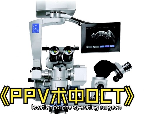 【中英双字】【PPV术中OCT】Surgery Intraoperative OCT during Pars Plana Vitrectomy