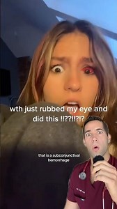 What happened to her eye?!