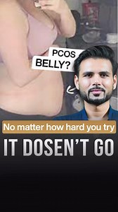 Pcos belly!!! How to get rid of it… . . Pcos pcod is a tough condition to tackle, especially the weight management part, also u get fat deposition at places you don’t want and it’s difficult to get rid of it…only diet and workout also don’t work you need a proper approach with hormone Managment and lifestyle modification in a wholesome manner, sleep, diet , meds, supplements etc. . Fertility specialists, best fertility specialists, gynaecologist in vadodara, gynaecologist in Anand, gynaecologist