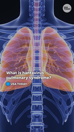 Authorities say hantavirus pulmonary syndrome was the cause of death for Betsy Arakawa, wife of actor Gene Hackman. Here's what you need to know about the rare disease. | USA TODAY