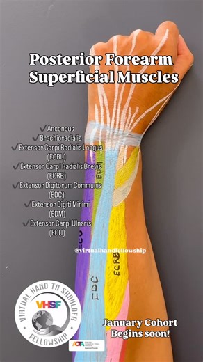 Virtual Hand to Shoulder Fellowship on Instagram: "At VHSF, we go beyond continuing education. The Virtual Hand Therapy Fellowship provides the rigor of higher education with the accessibility of continuing education for working clinicians committed to advancing practice in upper limb and hand rehabilitation. Today’s reel highlights the superficial posterior compartment, a set of muscles that many clinicians can list, but fewer can consistently apply to clinical reasoning. In the fellowship, fou