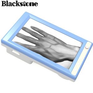 [Hot Item] LCD Screen Handheld Vein Viewer Infrared Human & Veterinary Portable Vein Finder