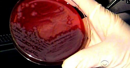 CDC: Staff possibly exposed to anthrax bacteria