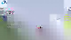 Complex Edentulous Cases？🧐 →Take it easy with Helios 500 #intraoralscanner #Eighteeth #dentaltechnology #instituteofdigitaldentistry #heilos500 | Eighteeth Medical