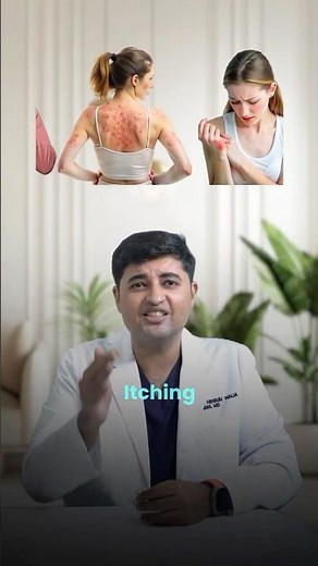 Allergy, Sneezing, Itching & Skin Rashes: Symptoms, Causes & Immune Reaction Explained