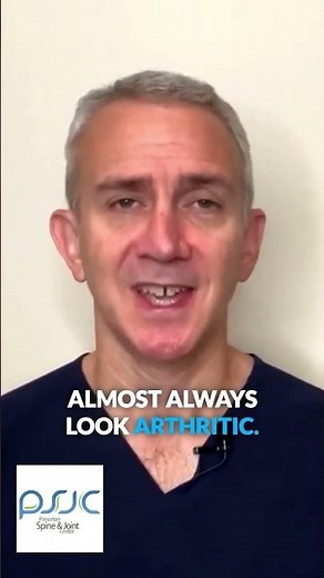 Arthritis by 30? Facet Joint Facts You Need to Know!