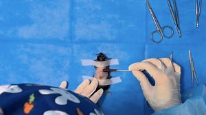 Mouse Wound Models and Preparation of Single-Cell Suspensions