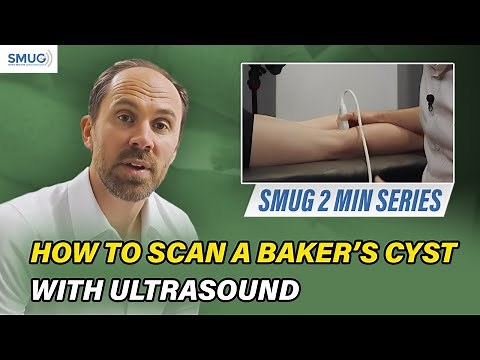 How to Scan a Baker’s Cyst with Ultrasound | MSK Knee Ultrasound Tutorial for Clinicians