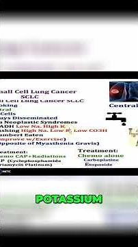 Small Cell Lung Cancer: Symptoms, Causes & Treatments in 2 minutes #shorts