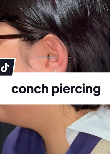 That moment when your conch piercing hits just right! Minimal pain, maximum slay. ✨ ⋆˚࿔ conch piercing done by @tengshii.planet ᢉ𐭩 Send us a DM to secure your slot. Walk-ins depend on availability. 💌 #needlemaniac #conchpiercing