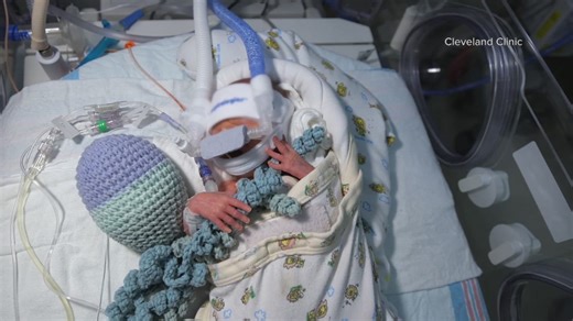 Crocheted octopi bring comfort to premature babies at Cleveland Clinic Children’s Hospital