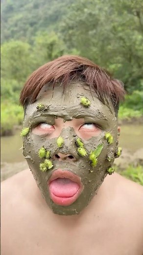 体に付いたダニを安全に除去！サバイバル応急対処テクニック#アウトドア #survival #outdoorlife